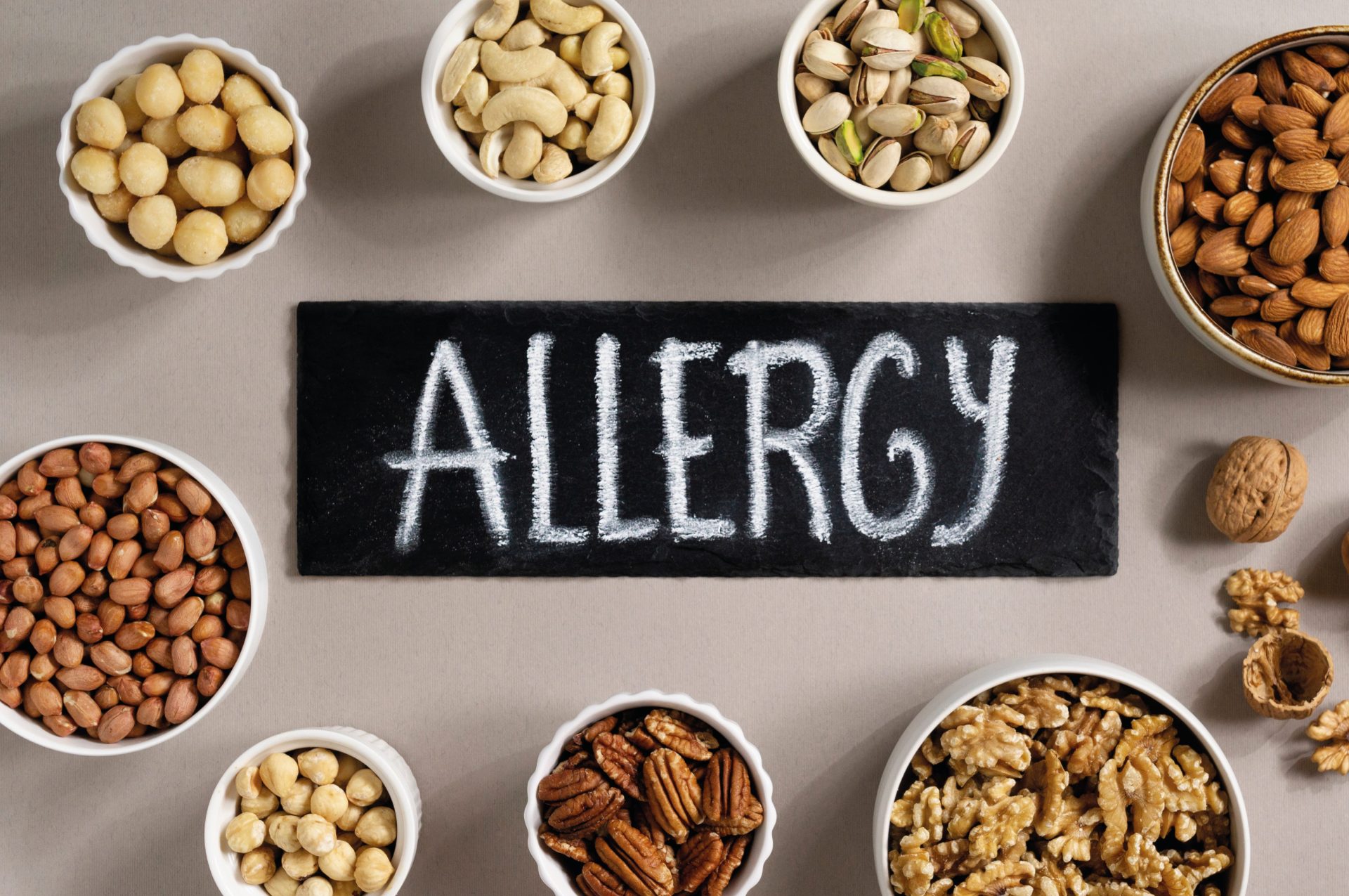 La guida per evitare gli allergeni alimentari La guida per evitare gli allergeni alimentari