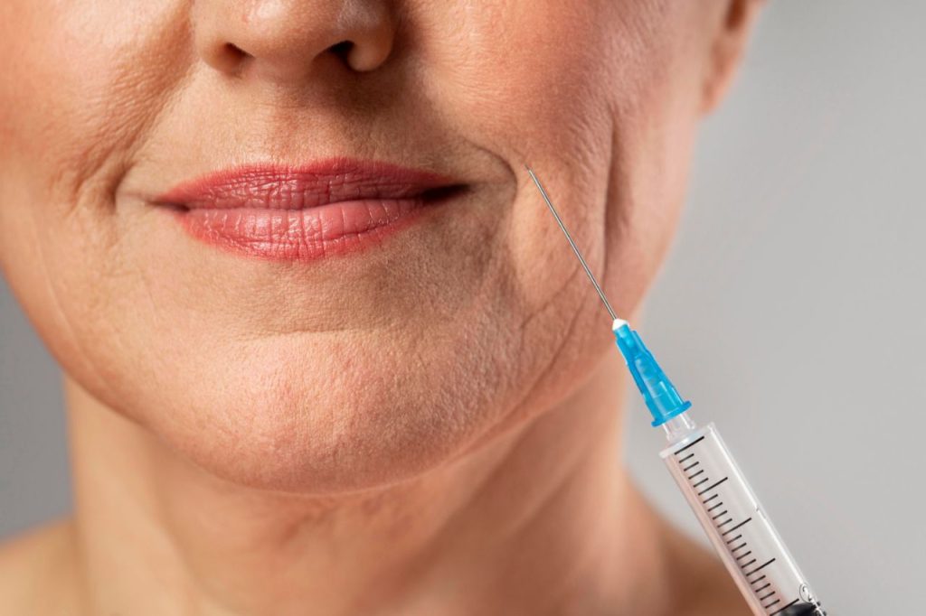 botox taranto botox taranto