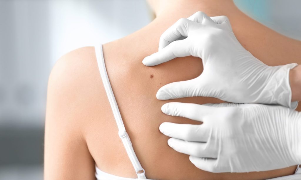 Visita Dermatologica a Taranto