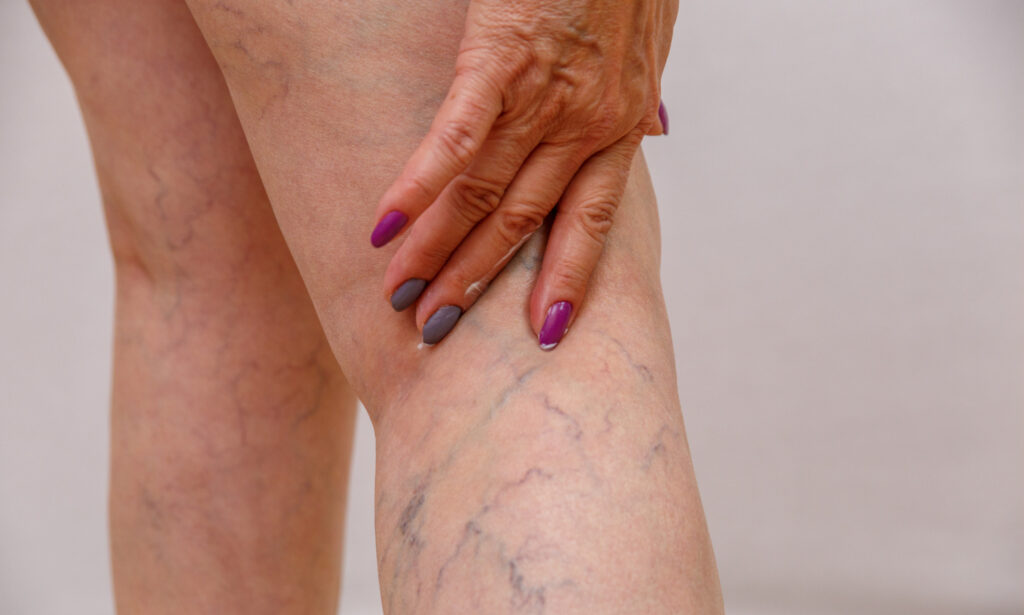 Visita Angiologica con doppler a Taranto